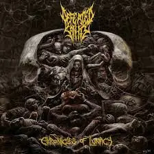 Defeated Sanity- Chronicles Of Lunacy 1